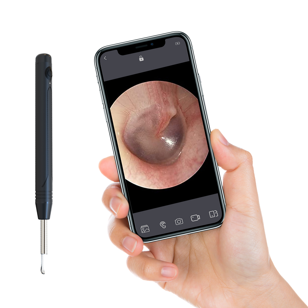 Main product image of Wireless 1080P Otoscope Endoscope Camera with LED and Ear Spoon